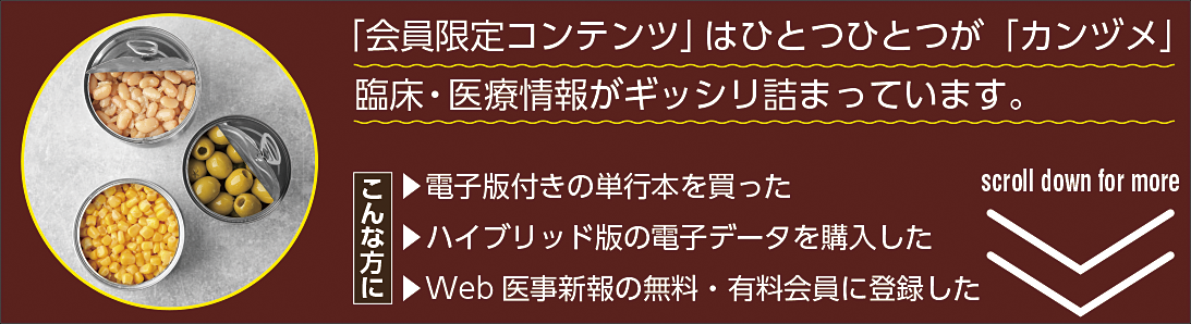 限定コンテンツバナー