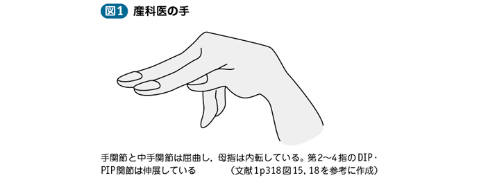 03_43_過換気症候群