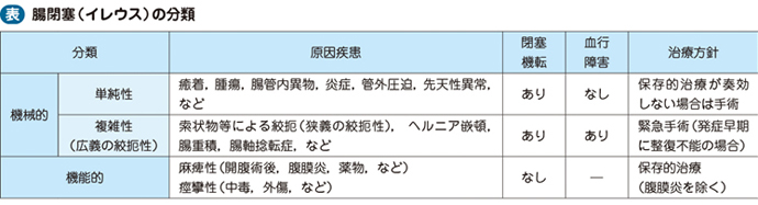 腸閉塞 イレウス 電子コンテンツ 日本医事新報社