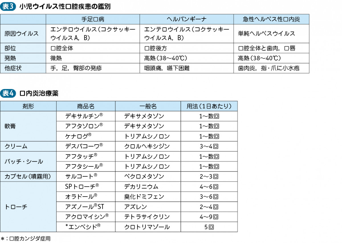 口腔 用 軟膏 デキサメタゾン