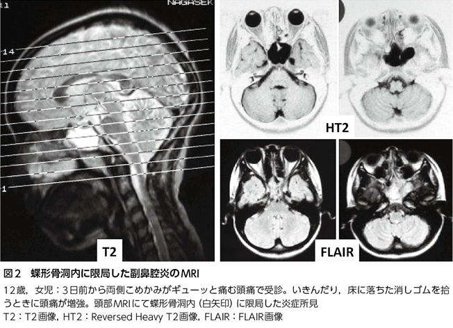 向く 痛い と を が 下 頭 頭を下げると頭痛後頭部の対処法