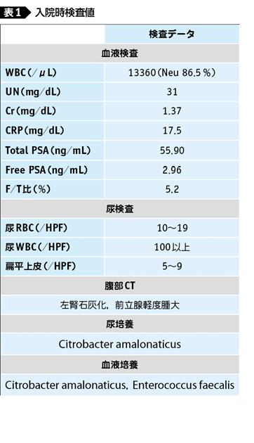 癌 psa 以上 前立腺 100