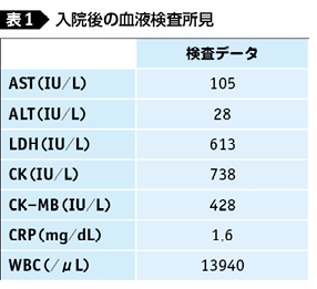 検査 ck 血液 クレアチンキナーゼ（ＣＫ）