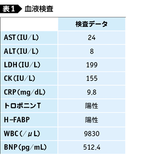 クレアチニン キナーゼ 基準 値