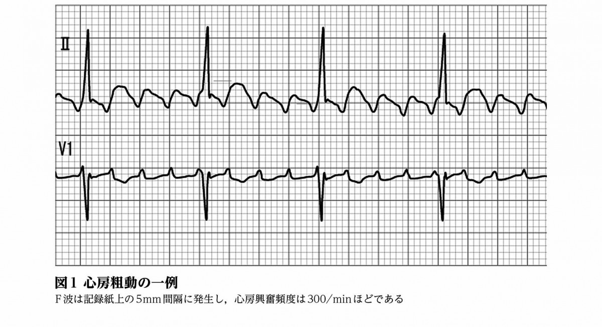 室 上 発作 拍 性 性 頻