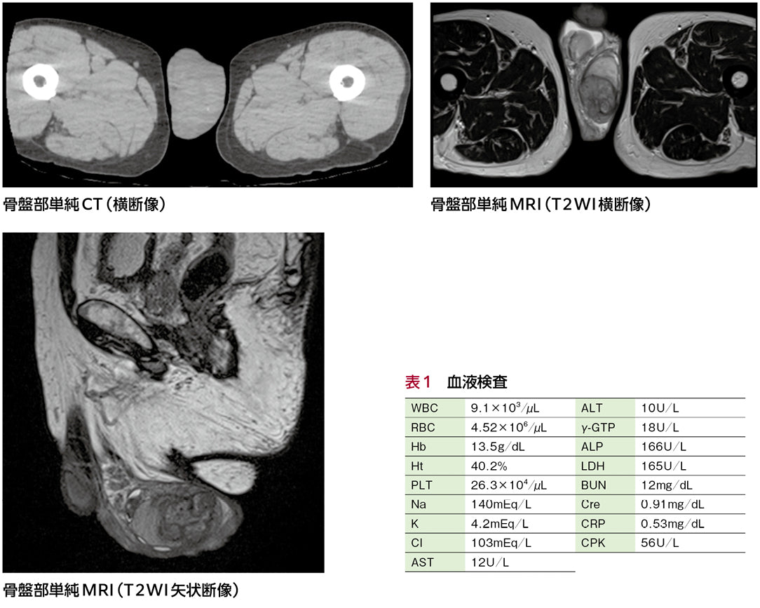 病歴を振り返ると……？［画像診断道場～実はこうだった（325）］