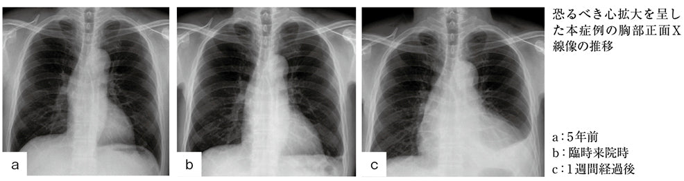 恐るべき心拡大（勝谷友宏）［プラタナス］