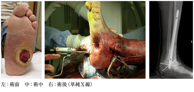 常識の先に見えた足病医療の原点〜“手術してはいけない足”が教えてくれたこと（菊池恭太）［プラタナス］