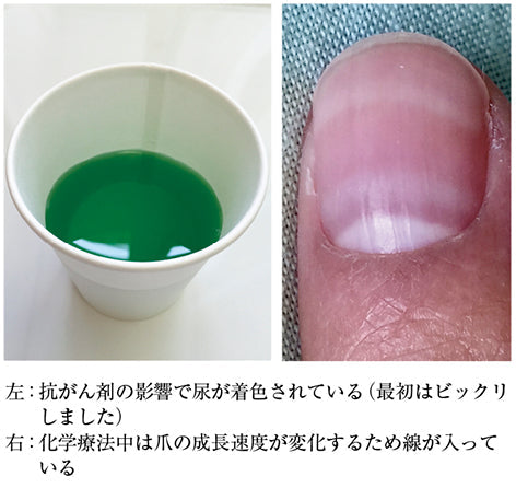 被ばくのプロになってしまった話（佐藤大祐）［プラタナス］