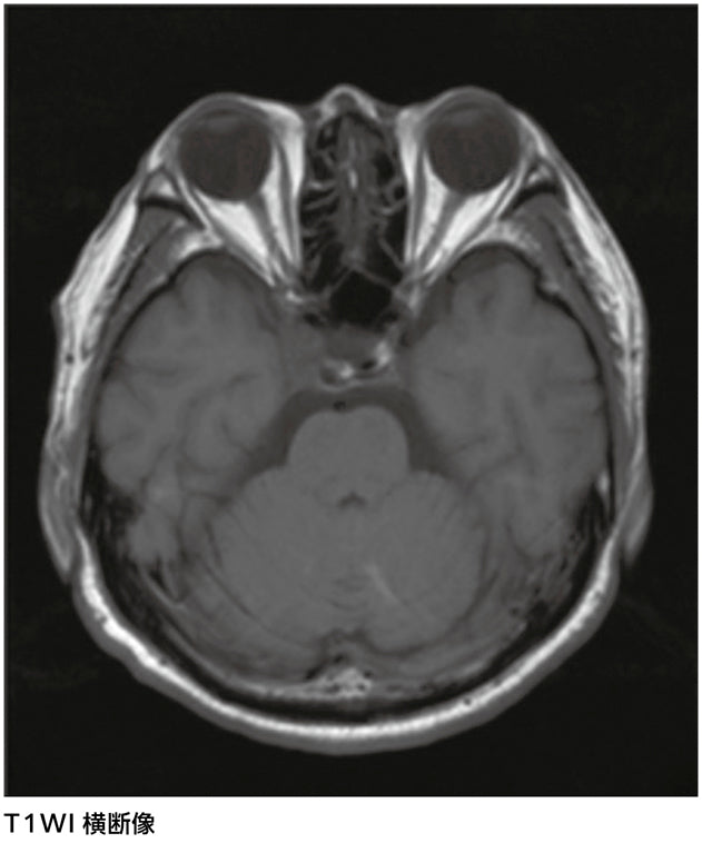 異常所見は？［画像診断道場～実はこうだった（332）］