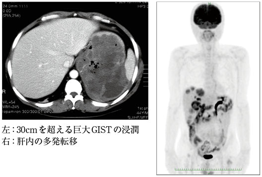 思い出に残る症例（馬場秀夫）［プラタナス］