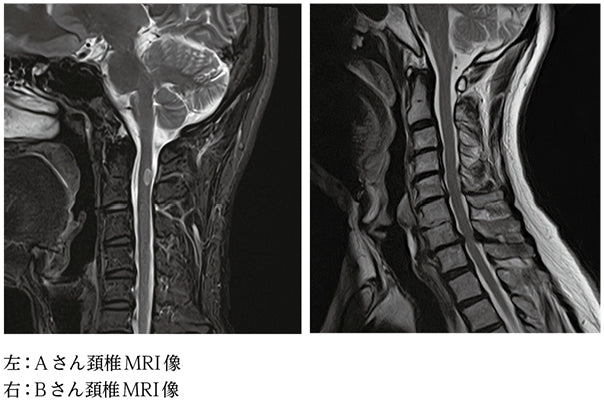 MRIの功罪（大堀靖夫）［プラタナス］