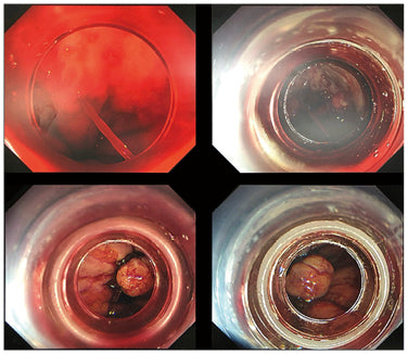 離島×総合診療×非専門医が握る内視鏡（宮川 峻）［プラタナス］