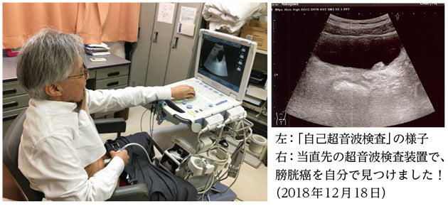 自分で見つけた膀胱癌（中川恵一）［プラタナス］