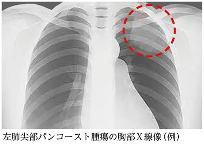仕事をしながら看病をする家族への視点（長嶺由衣子）［プラタナス］