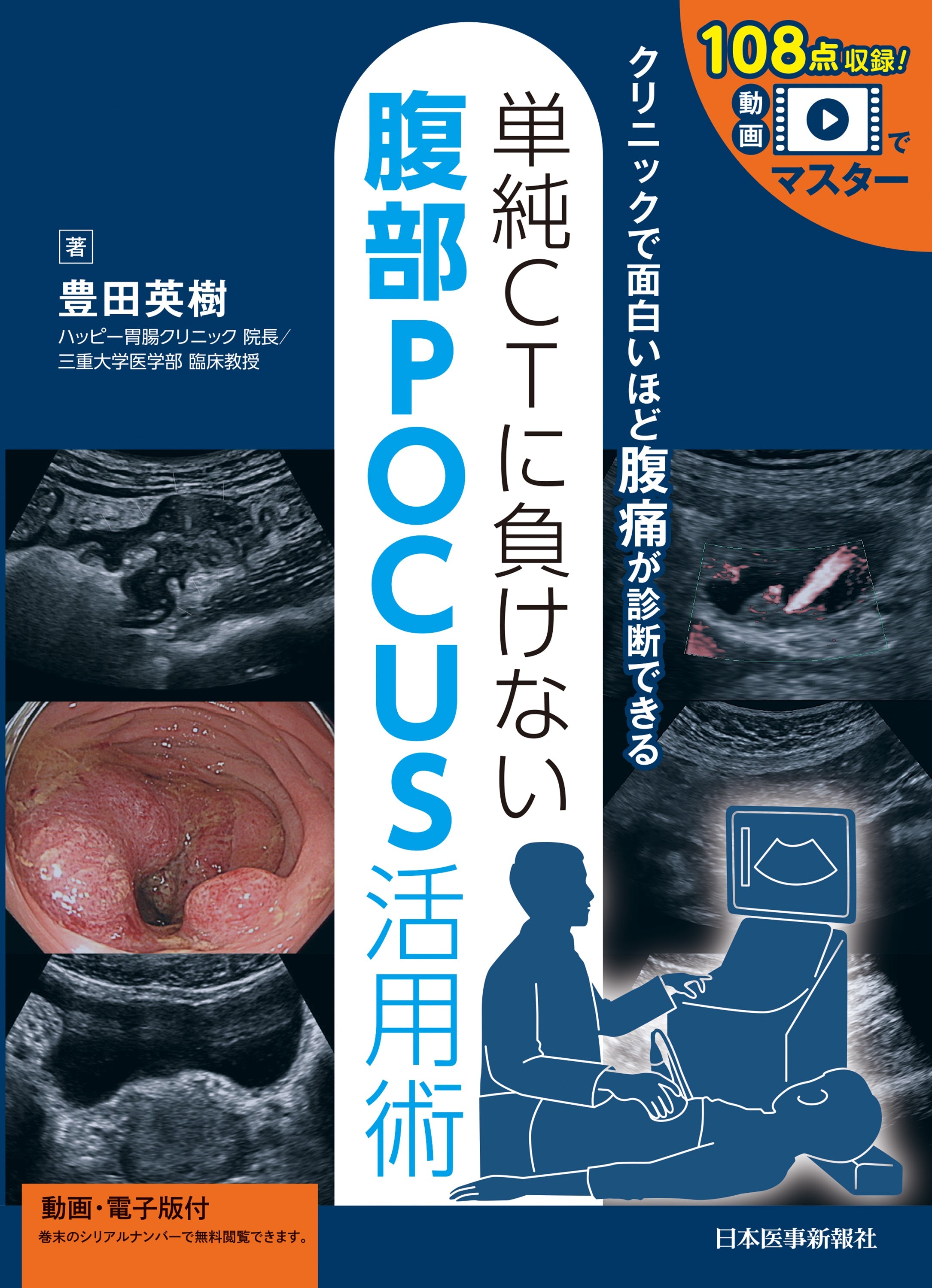 内視鏡のプロが語るエコーの威力，まさに鬼に金棒！『クリニックで面白いほど腹痛が診断できる単純CTに負けない腹部POCUS活用術』【書評】