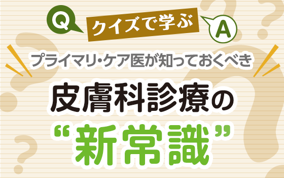 蕁麻疹の新常識：蕁麻疹におけるステロイドの位置づけ［〈プライマリ・ケア医が知っておくべき〉クイズで学ぶ 皮膚科診療の“新常識”（25）］