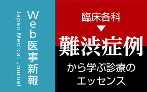 中毒性表皮壊死症様皮疹をきっかけに診断に至った全身性エリテマトーデス［難渋症例から学ぶ診療のエッセンス（208）］