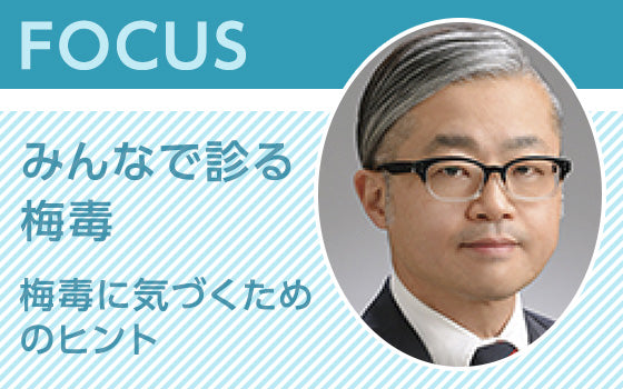 FOCUS：みんなで診る梅毒〈梅毒に気づくためのヒント〉