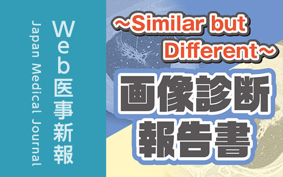 高吸収域を含む大腿部腫瘤！鑑別は……？［Similar but Different〜画像診断報告書（20）］