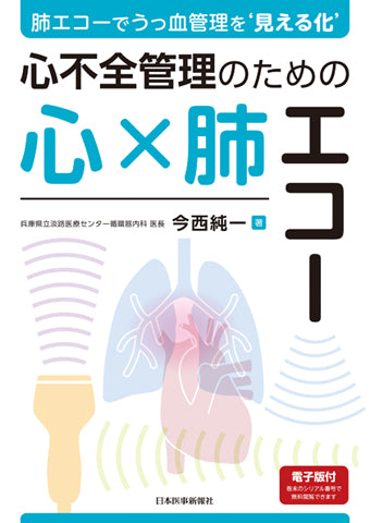 心エコー 2018年 09 月号 [雑誌] 71beuc6zRJL.jpg