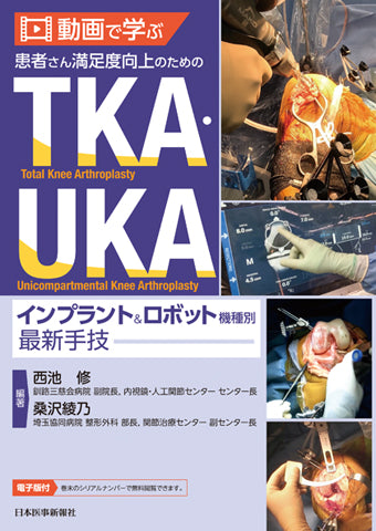 動画で学ぶ　患者さん満足度向上のためのTKA・UKA