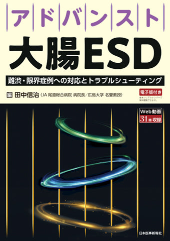 アドバンスト大腸ESD