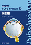 よくわかる病態生理 13　眼疾患