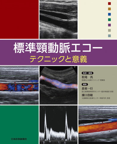 標準頸動脈エコー：テクニックと意義