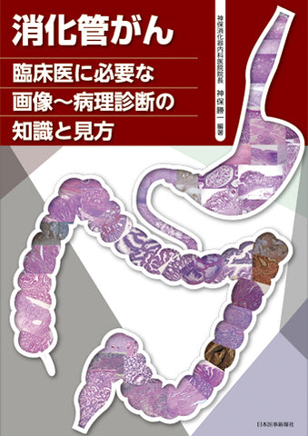 消化管がん