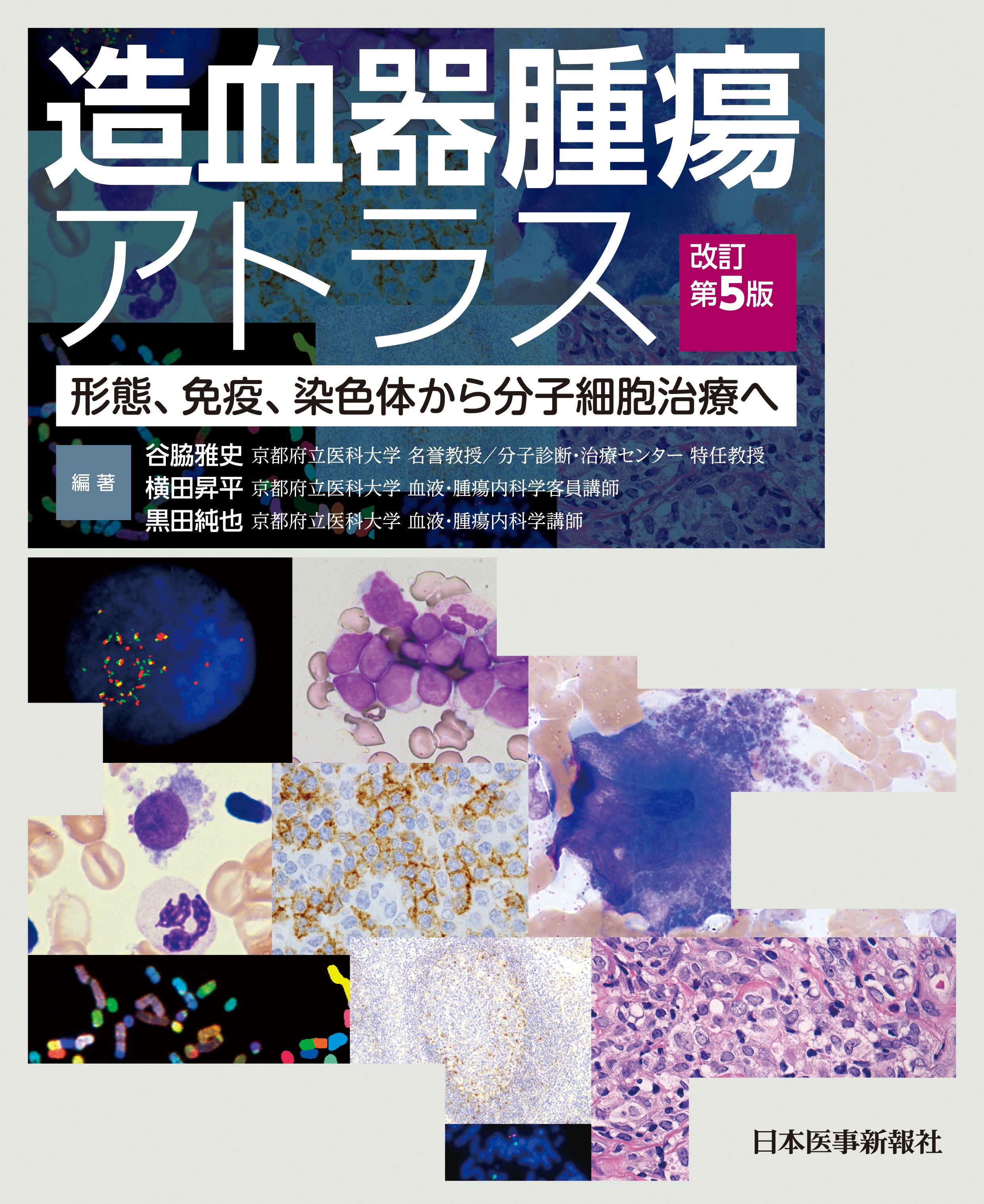 造血器腫瘍アトラス〈第5版〉