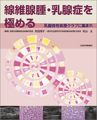 線維腺腫・乳腺症を極める