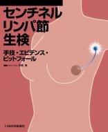 センチネルリンパ節生検