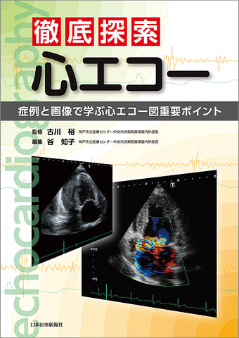 徹底探索　心エコー