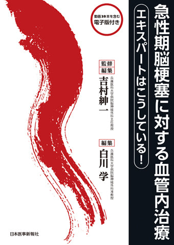 急性期脳梗塞に対する血管内治療 – 日本医事新報社