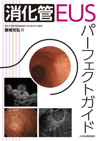 消化管EUSパーフェクトガイド