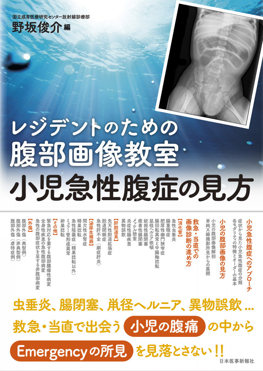 レジデントのための腹部画像教室【小児急性腹症の見方】