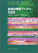 皮膚科典型アトラス560 – 日本医事新報社