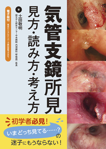 気管支鏡所見【電子版付】