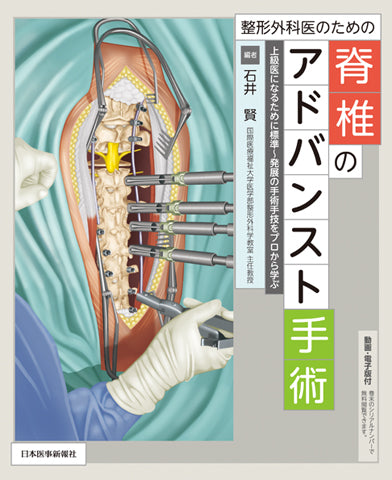 若手脊椎外科医のための内視鏡手術ガイド 若手脊椎外科医のための内視鏡手術ガイド 岩井グループの技術の