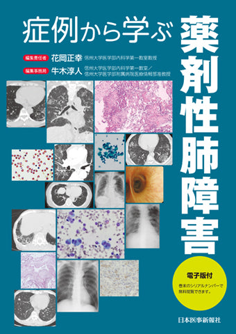 症例から学ぶ薬剤性肺障害【電子版付】 – 日本医事新報社