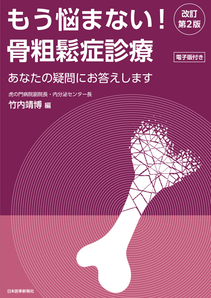 【裁断済み】骨粗鬆症雑誌セット もう悩まない！骨粗鬆症診療＜改訂第2版＞ – 日本医事新報社