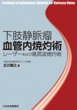下肢静脈瘤血管内焼灼術 – 日本医事新報社