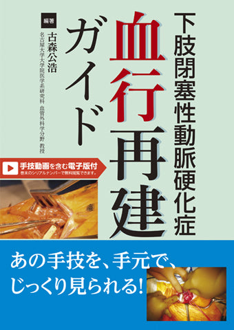 下肢閉塞性動脈硬化症 血行再建ガイド【手技動画を含む電子版付】