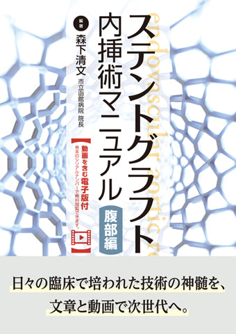 ステントグラフト内挿術マニュアル 腹部編【動画を含む電子版付】