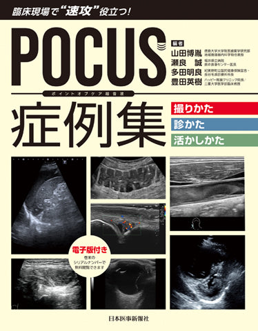POCUS症例集