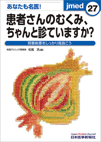 あなたも名医！患者さんのむくみ、ちゃんと診ていますか？