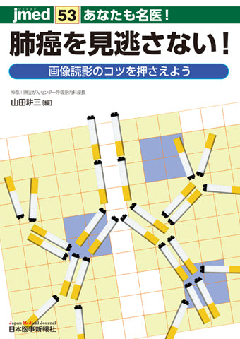 あなたも名医！肺癌を見逃さない！