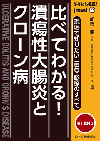 あなたも名医！現場で知りたいIBD診療のすべて　比べてわかる！潰瘍性大腸炎とクローン病【電子版付】