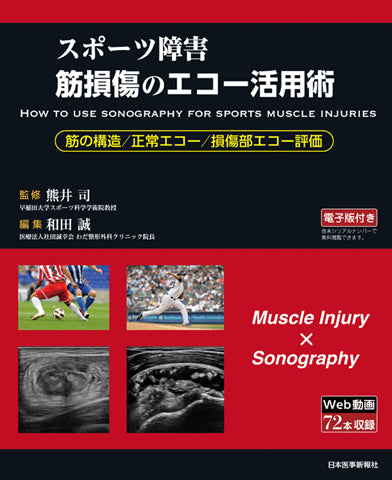 スポーツ障害＞筋損傷のエコー活用術 – 日本医事新報社